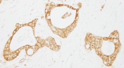 USP3 Antibody, Novus Biologicals 0.1mg; Unlabeled:Antibodies, Polyclonal